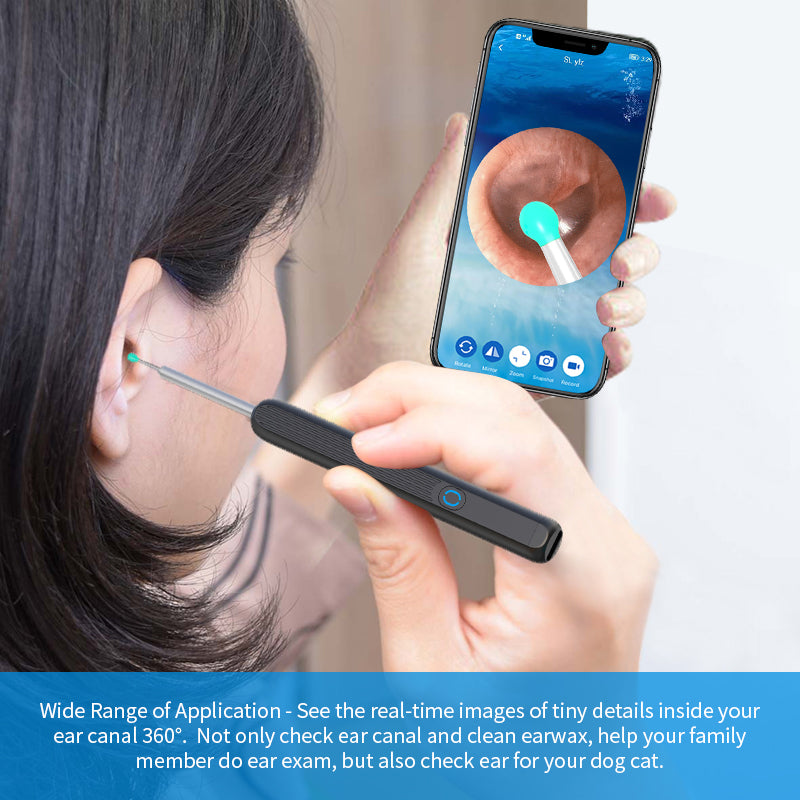 NE3 Ear Cleaner Otoscope Ear Cleaning Kit For I-phone